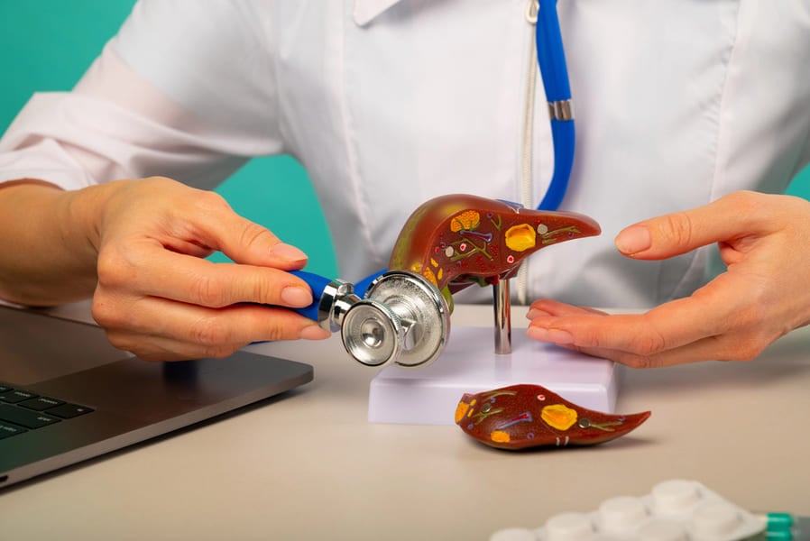 Полезно ли е киселото мляко за черния дроб