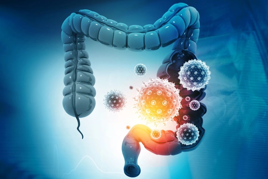 Диспепсия - причини, симптоми и лечение 9 Какво е диспепсия - причини и симптоми