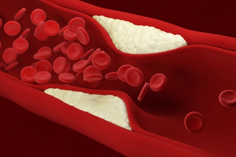 Хранителни добавки за прочистване на кръвоносните съдове 9 Хранителни добавки за прочистване на кръвоносните съдове