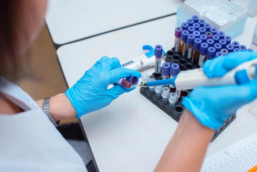 „Хормонална диета“ – как работи и има ли ефект? 9 Хормонална диета.