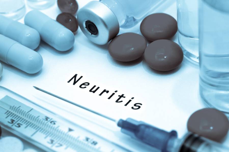 неврит