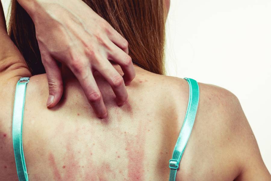 обрив от стрес