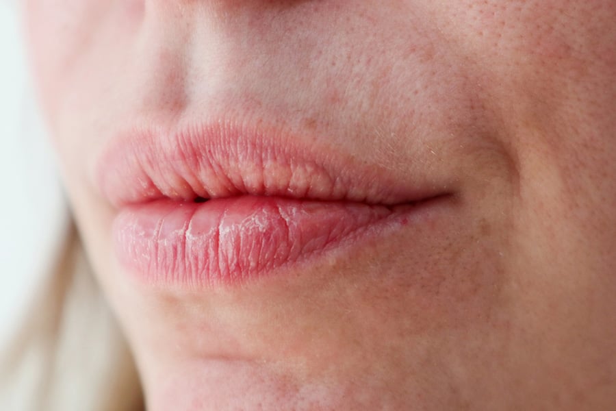 Сухота в устата: Причини и лесни домашни решения 23 suhota v ustata prichini i lesni domashni resheniya