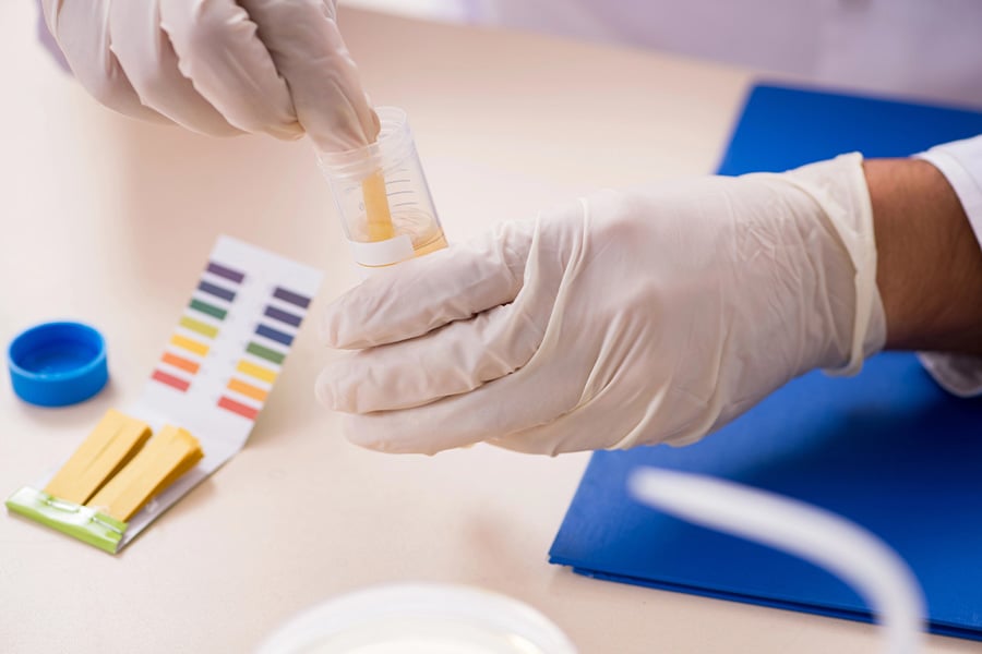 зелена урина, урина, тест