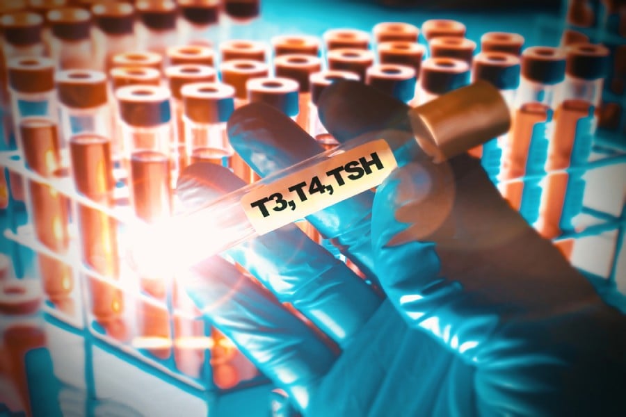 ашваганда и Хашимото, T3, T4, TSH, хормони, изследвания