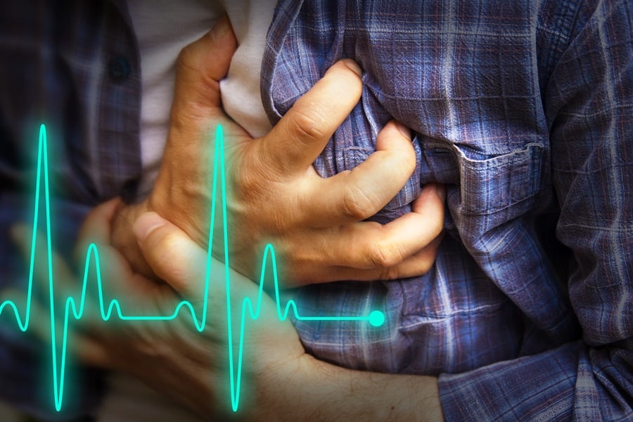 Инфаркт на миокарда