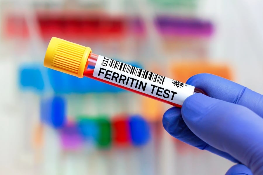 Изследвания за недостиг на желязо