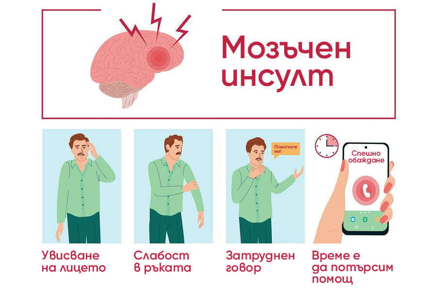Микроинсулт: какво е, защо често остава незабелязан и как се открива? 9 Симптоми на иснулт и микроинсулт