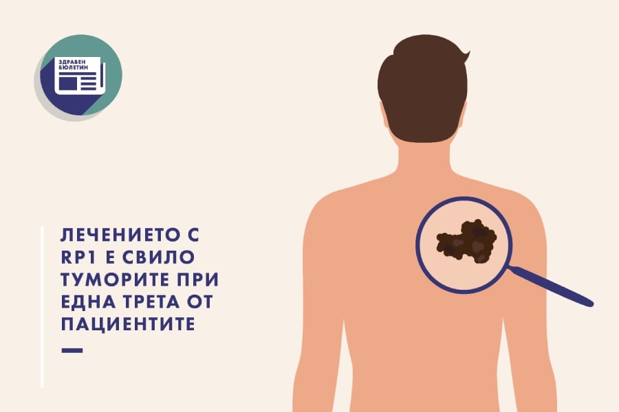 меланом, здравен бюлетин