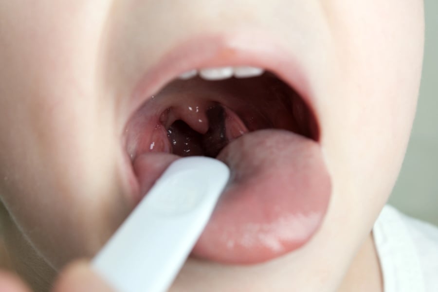 Преглед на дете със зачервено гърло