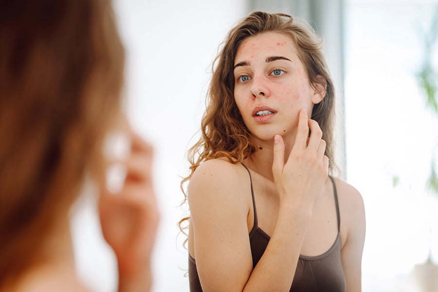 SHBG, тестостерон и кожа - връзката, която никой не обяснява 29 хормони и кожа, жена се оглежда в огледалото