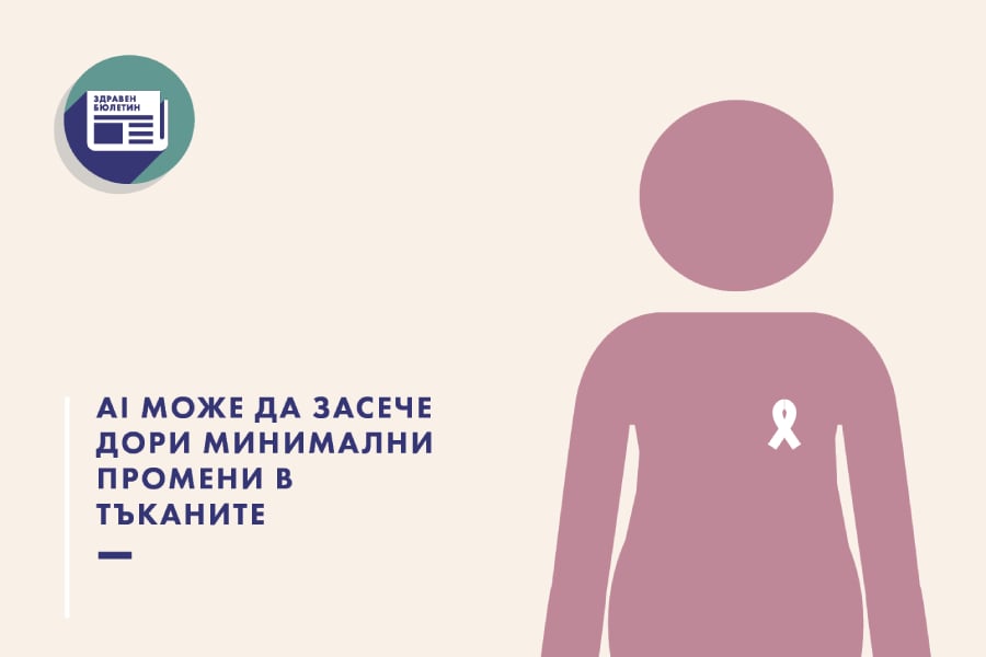 Изкуствен интелект може да предрича рака на гърдата до 5 г. по-рано 7 изкуствен интелект, рак на гърдата, здравен бюлетин